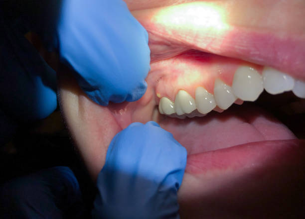 Best Emergency Treatment for Toothache in Portsmouth, OH